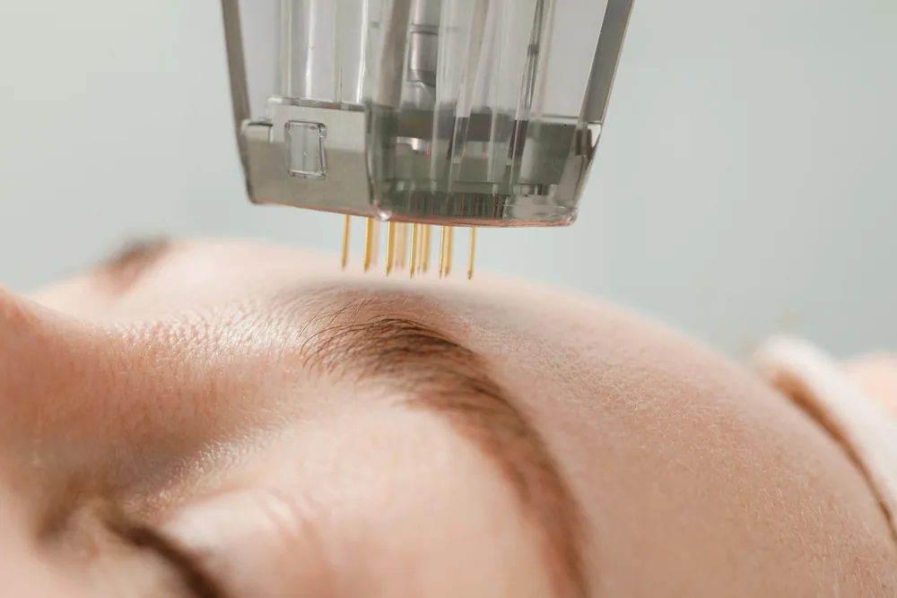Imagem editorial relacionada ao protocolo Face Firming